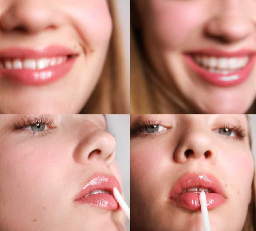Platinum Lip Plump